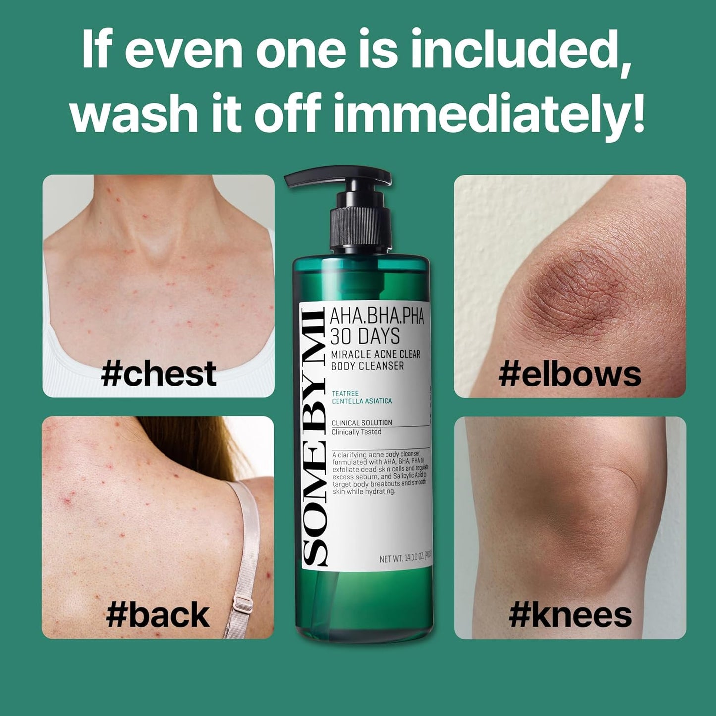 SOME BY MI AHA BHA PHA 30 Days Miracle Acne Clear Body Cleanse (14.1 oz. /400g)