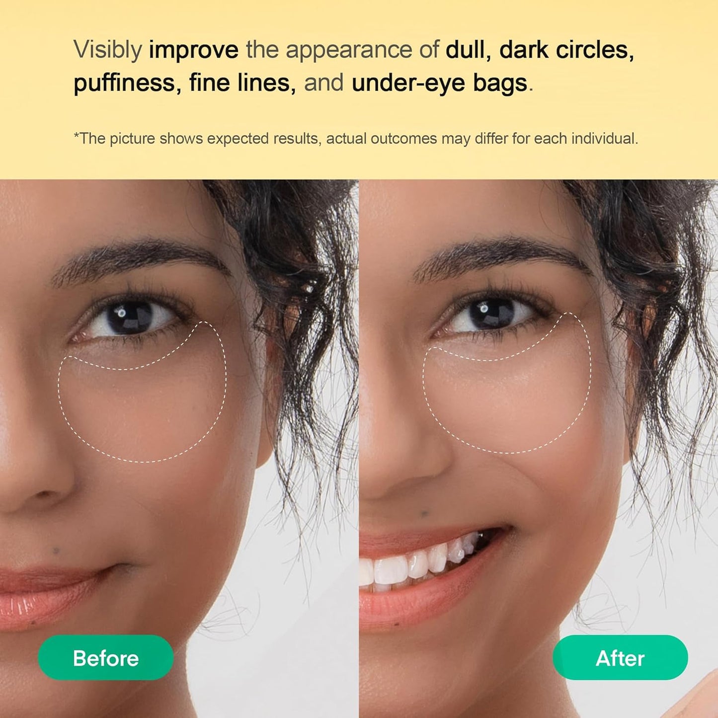 Terez & Honor Vitamin C Niacinamide Eye Patches