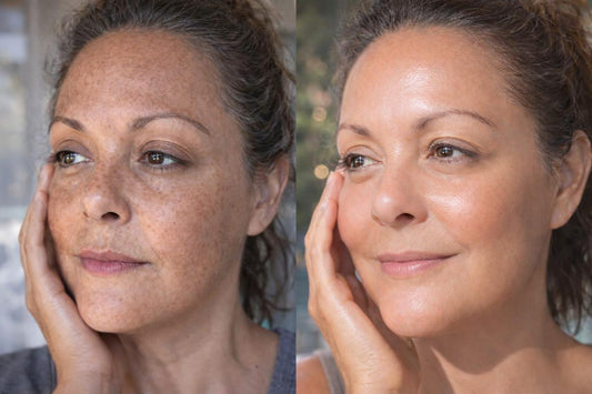 The Korean Way to Fix Uneven Skin Tone (Without Overdoing It)