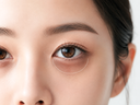 How to Get Rid of Dark Circles: Causes & K-Beauty Solutions