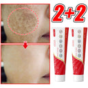 Luphya Melanin Pigmentation Spot Cream