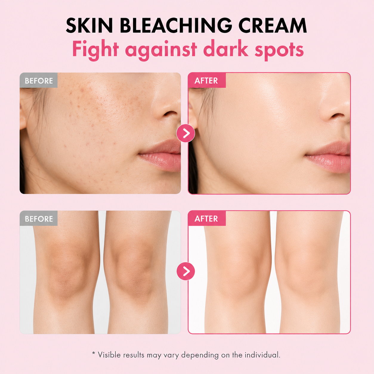 TOSOWOONG Dark Spot 35 Fade Cream, 50ml / 1.69 fl. oz.