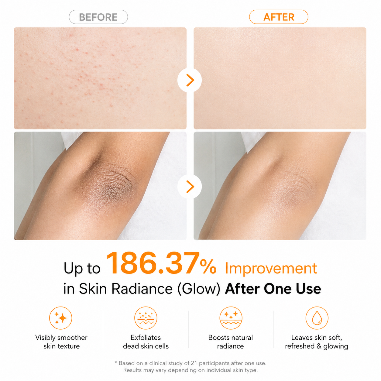 Dr.Melaxin Body Keratin Care Kojic Acid Turmeric Spray 200ml