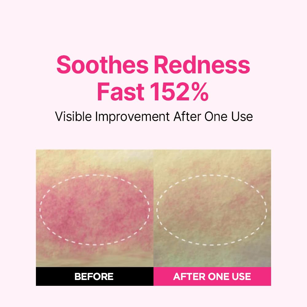 ISOI Blemish Care Up Serum for Face (1.18 Fl.Oz/ 35ml)