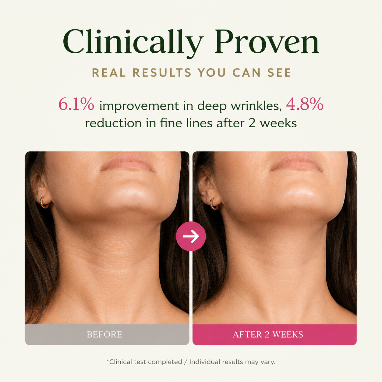 CKD Retino Collagen Gua Sha Neck Cream with Stainless Steel Roller, 1.69 fl oz