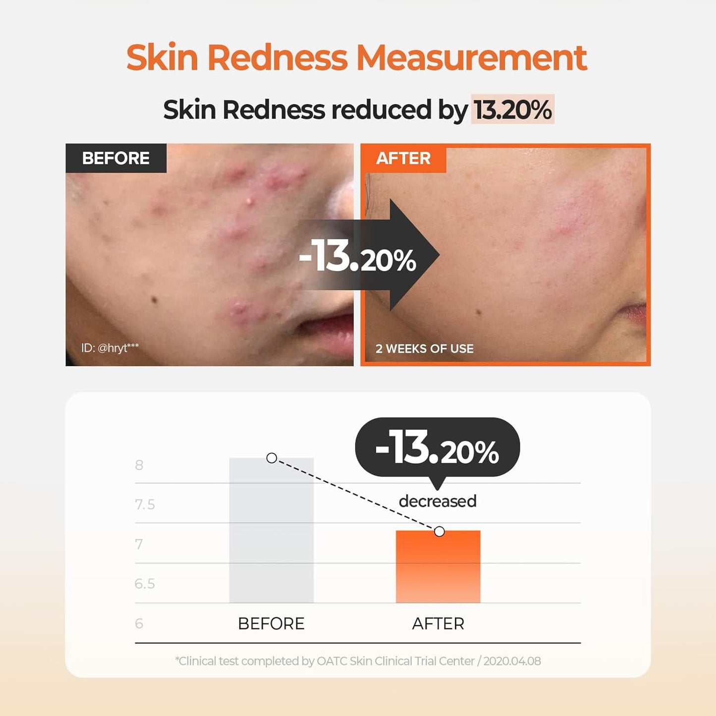 SKINFOOD Carrot Carotene Calming Water Pad 250g (8.81 oz.) 60 Sheets