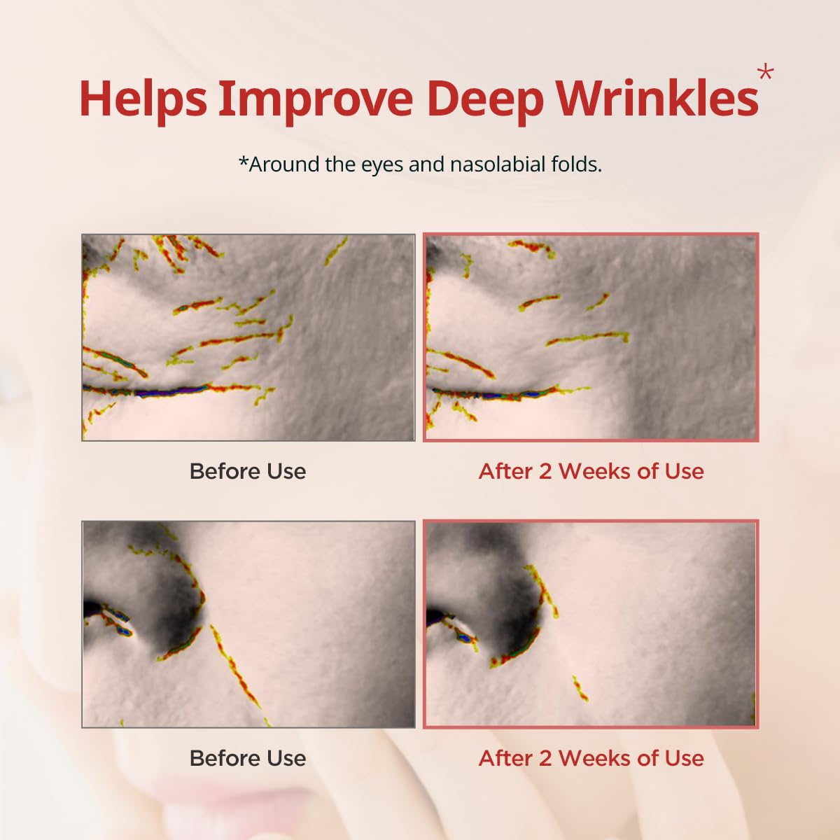 DERMATORY Pro Vita-A Retinal Under Eye Patch (60 sheets)