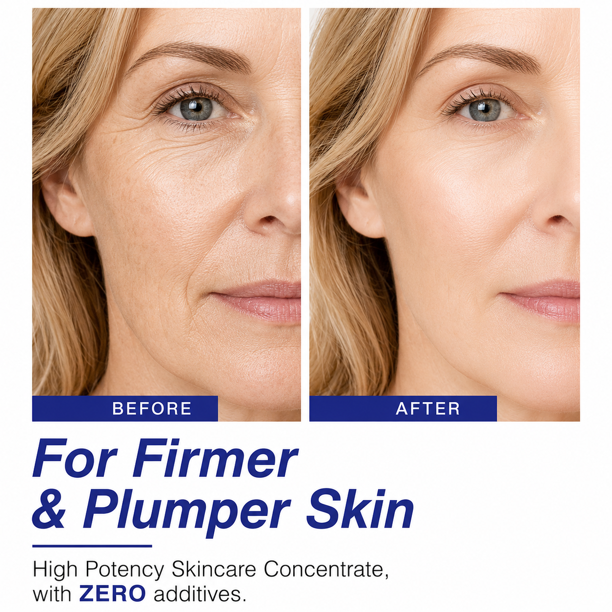 Volufiline 100% Concentrate Firming Serum for Sagging Skin