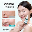 15% Vegan Niacinamide+ 3% Asam Traneksamat Serum