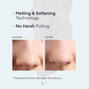 Terez & Honor Blackhead Remover Nose Pore Patches 5 Pcs