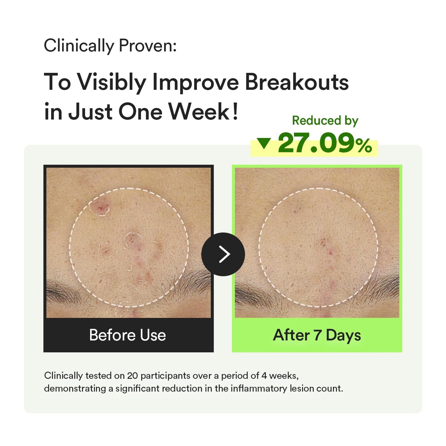 Abib Heartleaf TECA capsule serum Calming drop (1.69 Fl.Oz/ 50ml)