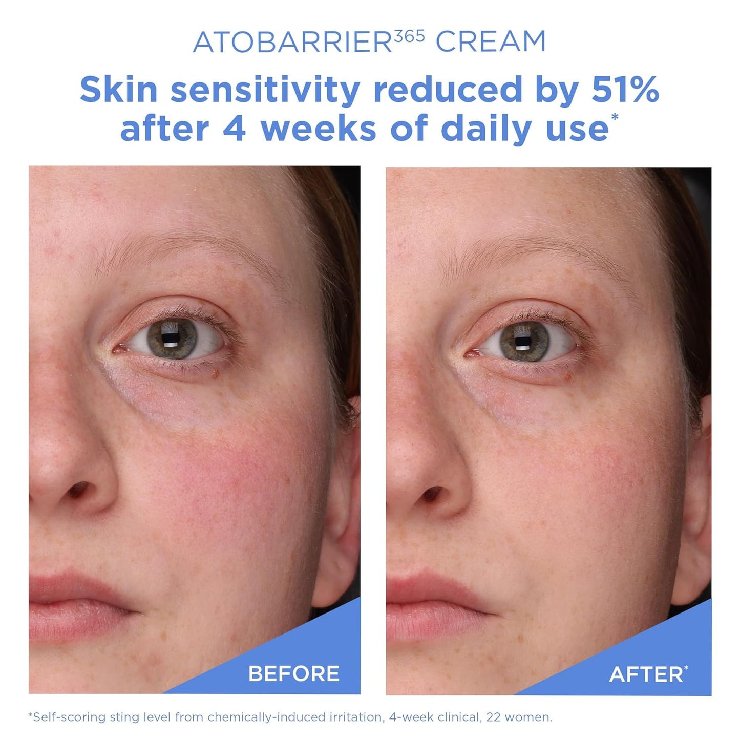 AESTURA ATOBARRIER365 Cream with Ceramide (2.70 Fl.Oz/ 80ml)