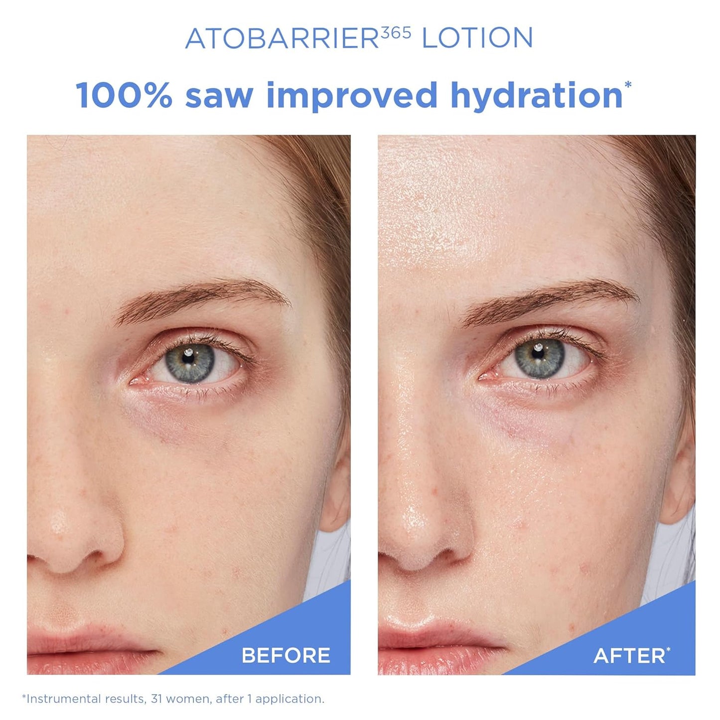 AESTURA ATOBARRIER365 Lightweight Korean Face Moisturizer with Ceramides (5.07 Fl.Oz /150ml)