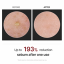 डॉ. मेलेक्सिन पील शट ग्लो चामल टोनर 200ml