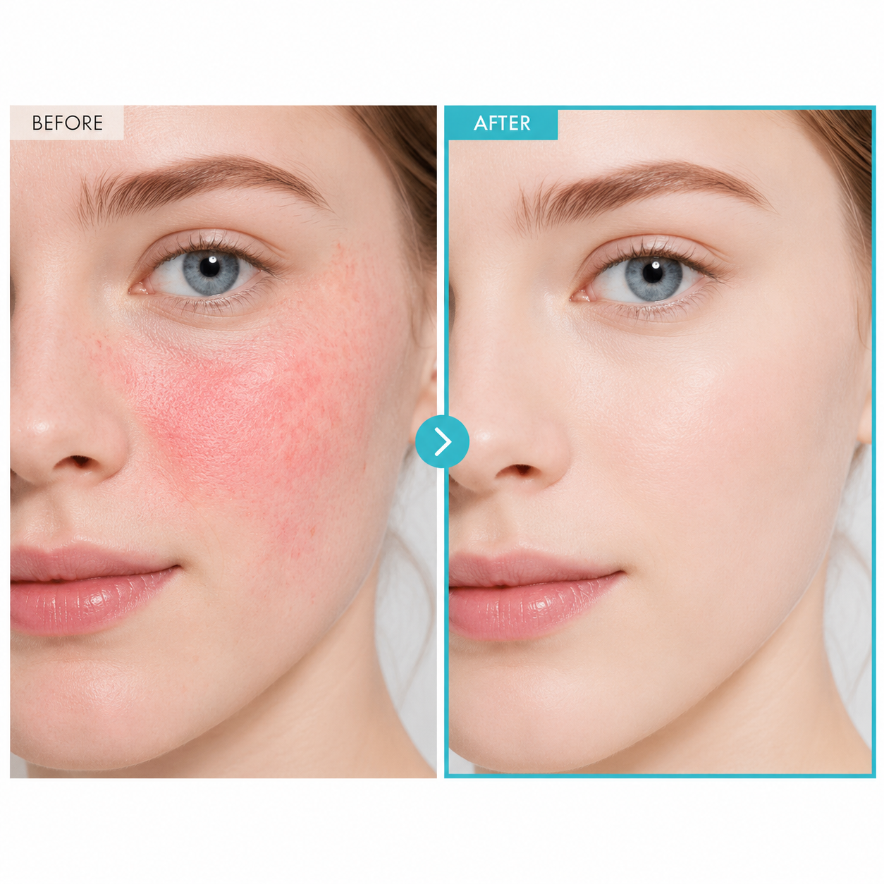TOSOWOONG SOS Repair CICA Clinic Zinc Cream, 100,000ppm Zinc Oxide, 50g, 1.76 oz.