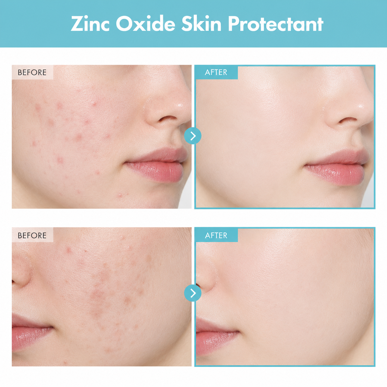 TOSOWOONG SOS Repair CICA Clinic Zinc Cream, 100,000ppm Zinc Oxide, 50g, 1.76 oz.