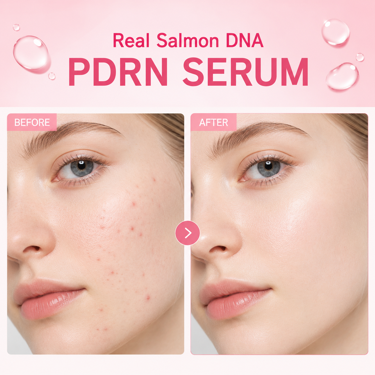 TOSOWOONG Pink Peptide 12 PDRN Serum - 1.11 fl.oz. (33ml)