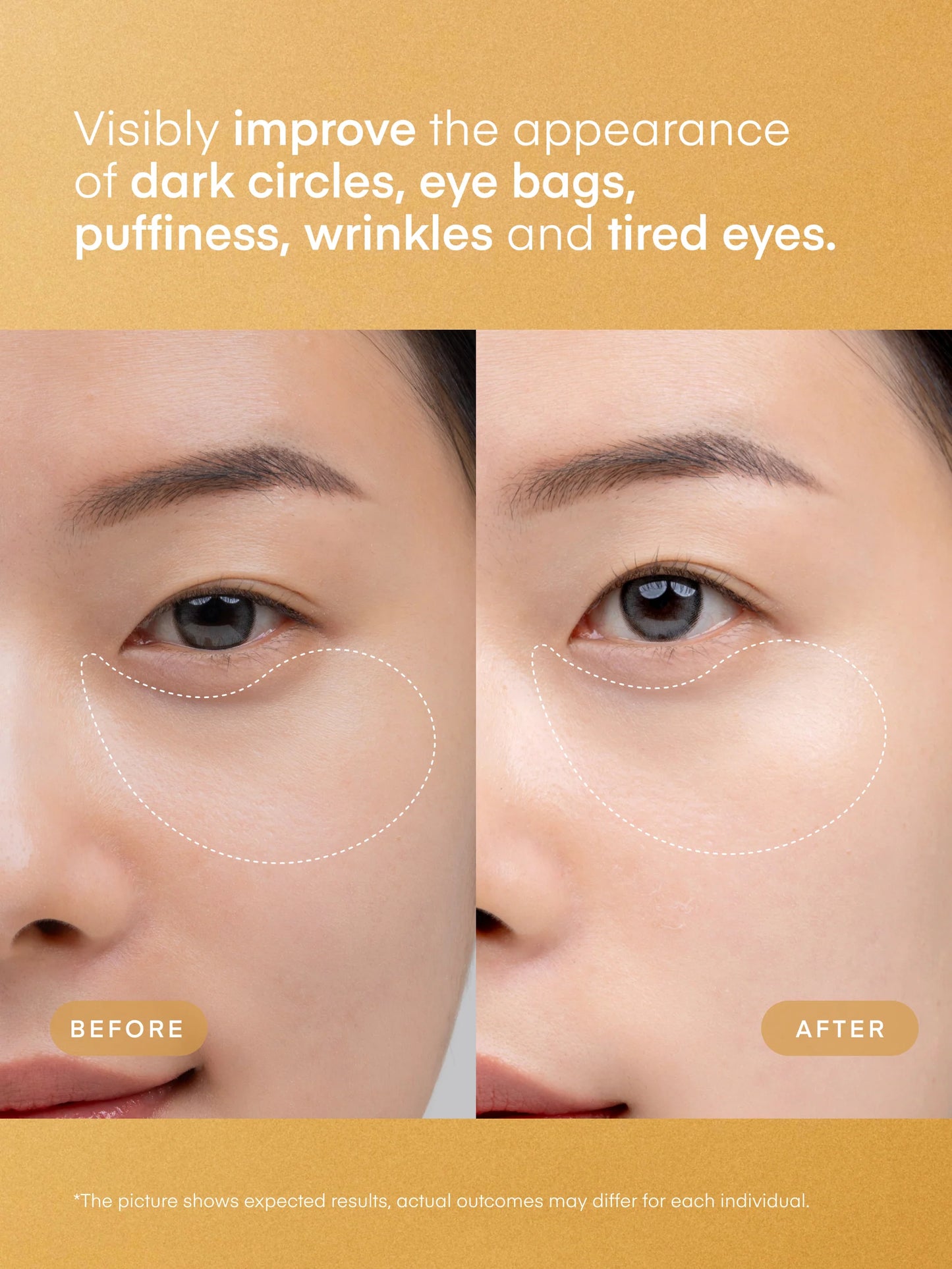 Terez & Honor 24K Gold Retinol Under Eye Patches - 60