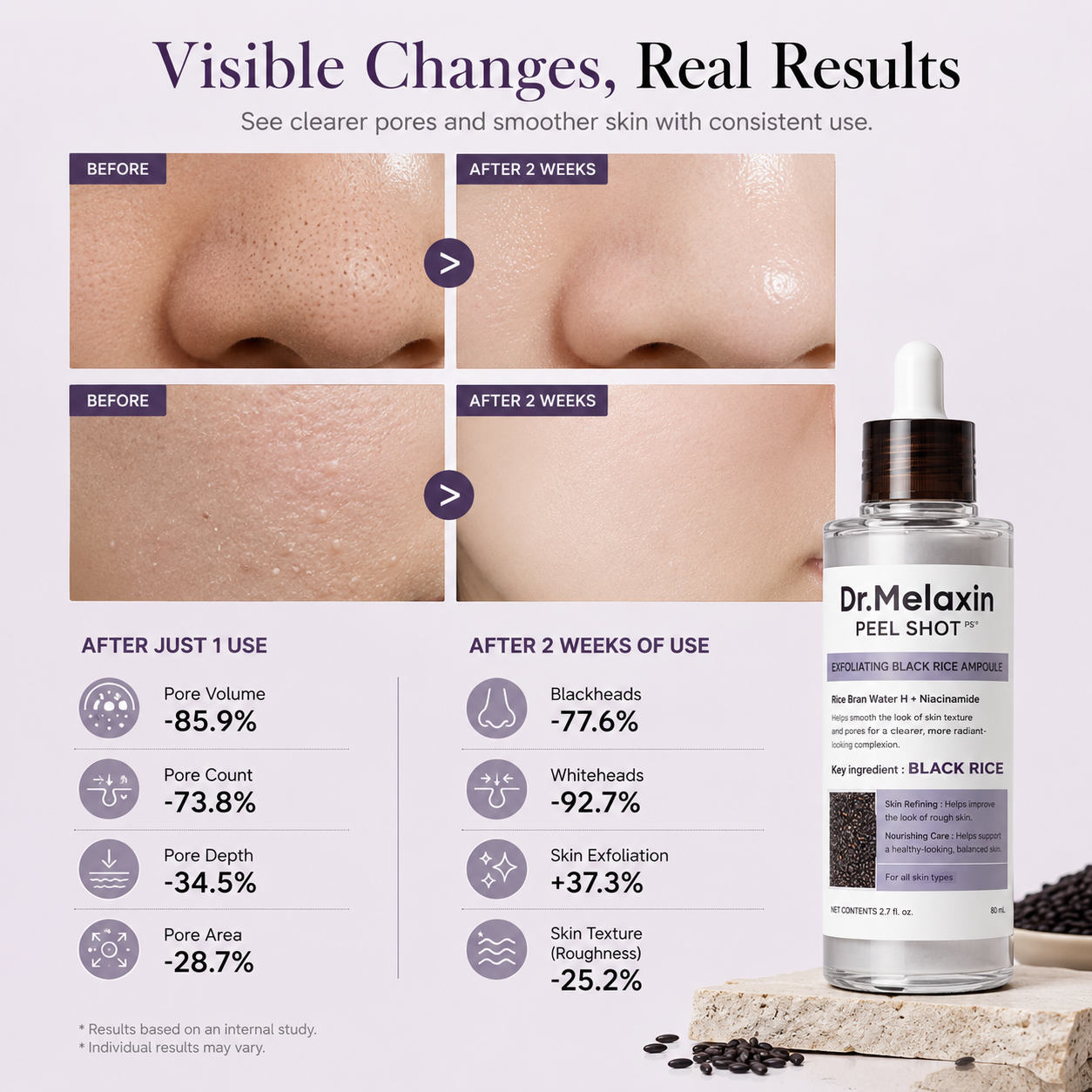 Dr.Melaxin Peel Shot Glow Black Rice Peeling Ampoule 80ml
