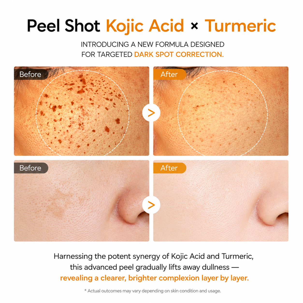 Dr.Melaxin Peel Shot Kojic Acid Turmeric Serum 80ml